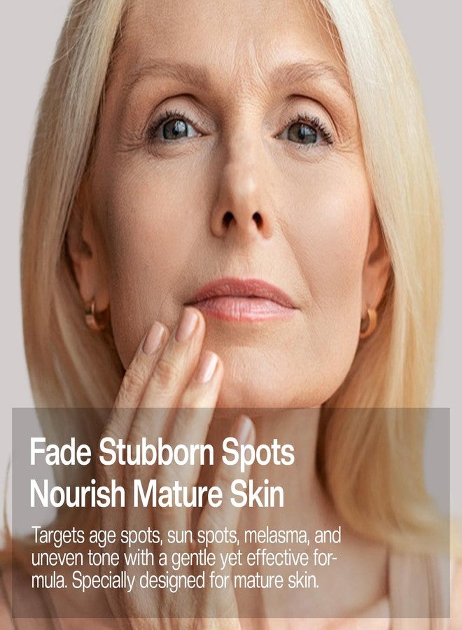 Jtopyrt Dark Spot Cream, Brightening Treatment Diminishes Age Spots, Sun-Damage, Liver Spots, Freckles & Discoloration For Younger Looking Skin - Fader & Corrector For Face, Chest, Hands & Body - Image 2